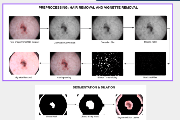 ProMorph: Skin Lesion Classification preview